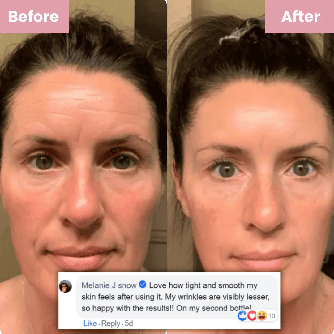 Elantherm Collagen Mask